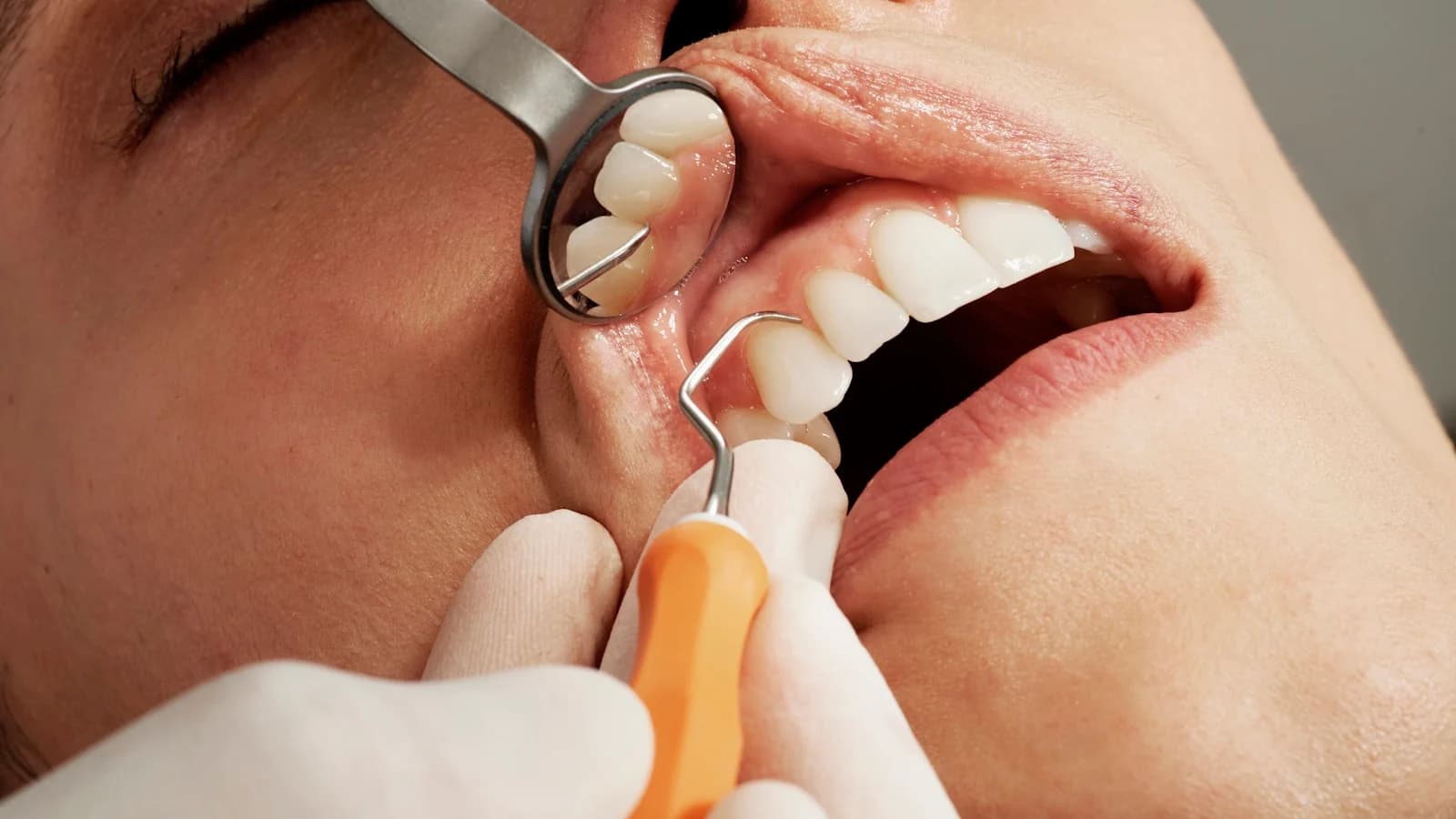 Dental Care in Denmark for Expats